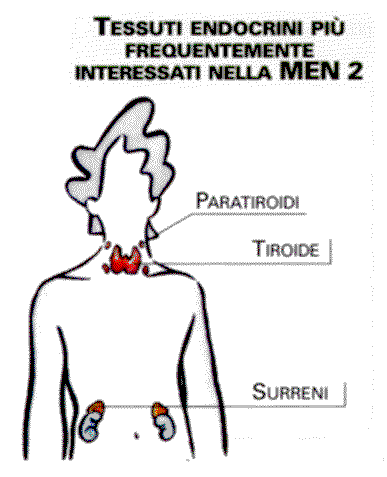 Tessuti Endocrini piu' frequentemente interessati nella MEN II